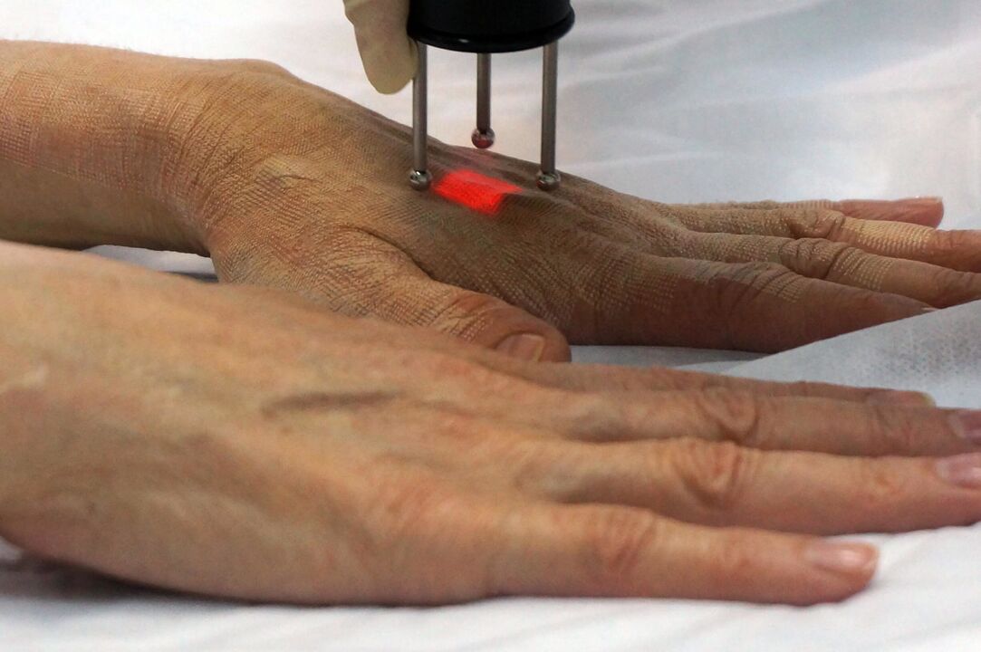 Rejuvenate hand skin by non-ablative method