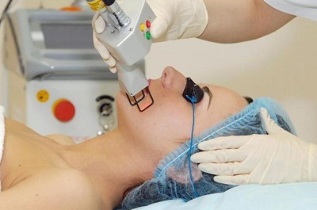 laser facial rejuvenation types